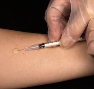 Testosterone injection under the skin